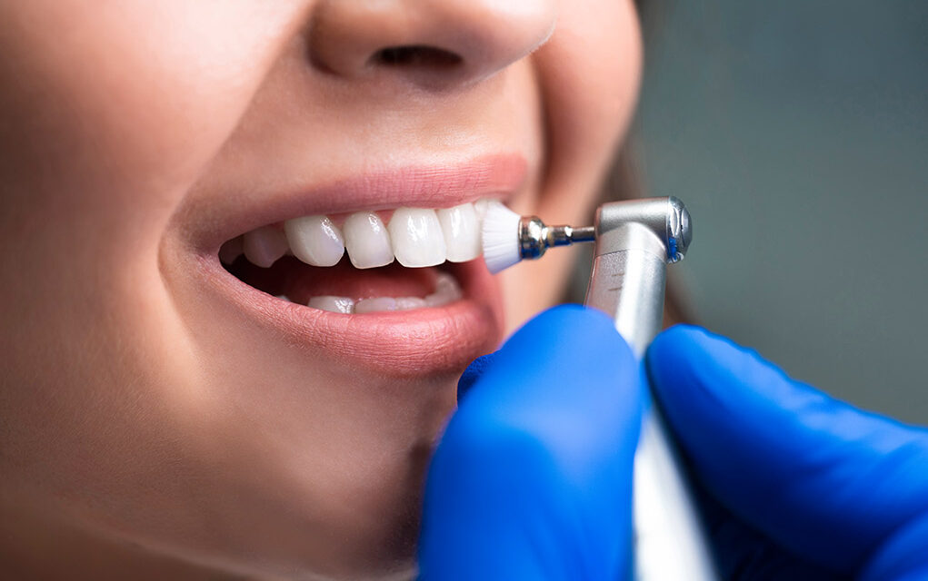 Dental Cleaning