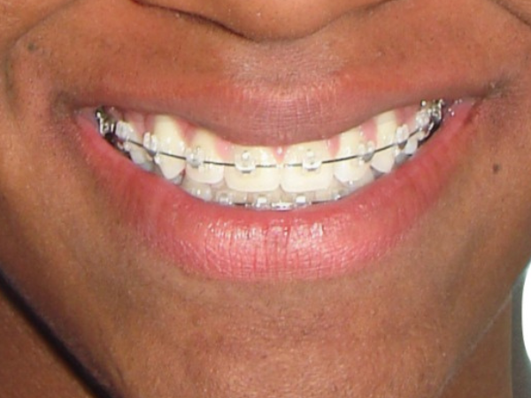 After
