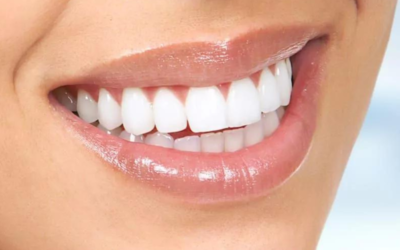 Dental Implants: The Definitive Solution for Missing Teeth