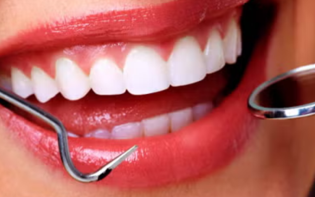 Do You Dream of a Bright, White Smile?