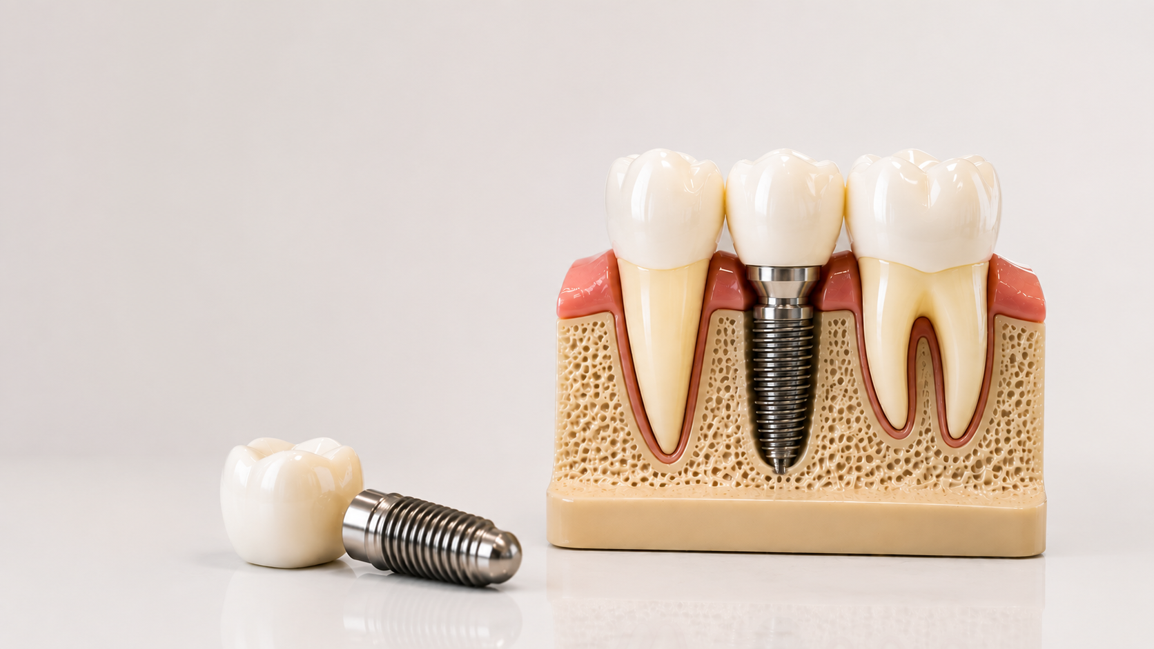 Implantology & Complete Rehabilitations